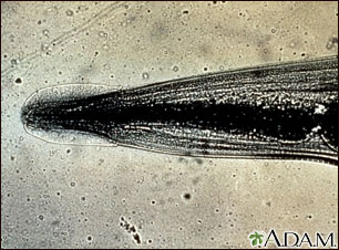 Lombriz intestinal: primer plano de la cabeza