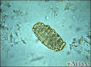 Huevo de Ascaris lumbricoides