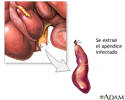 Procedimiento