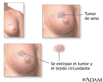 Procedimiento