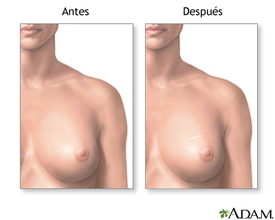 Cuidados postoperatorios