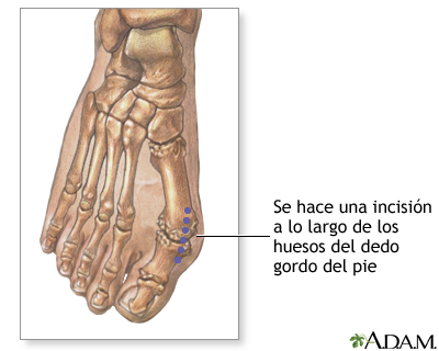 Procedimiento  (primera parte)