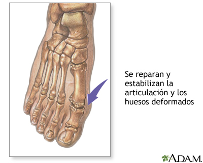 Procedimiento  (segunda parte)