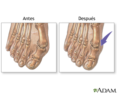 Cuidados postoperatorios