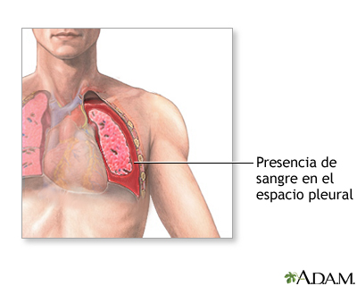 Indicaciones