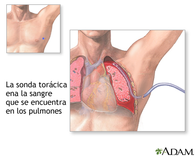 Procedimiento