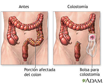 Cuidados postoperatorios