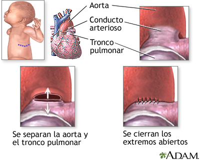 Procedimiento