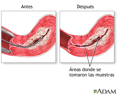 Cuidados postoperatorios