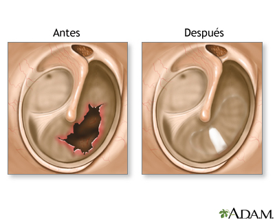 Cuidados postoperatorios