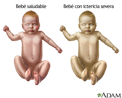 Indicaciones