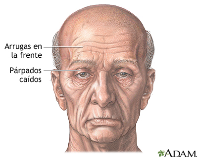 Indicaciones