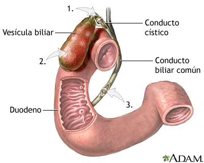 Indicaciones