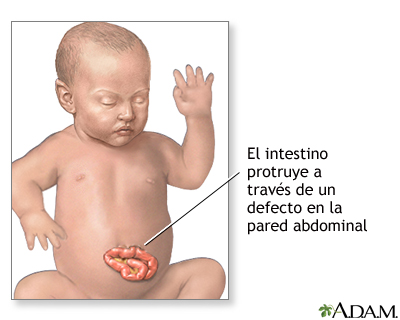 Indicaciones