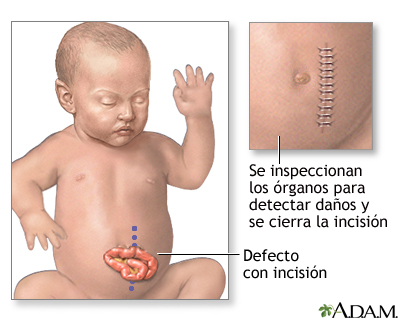 Procedimiento