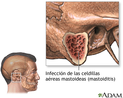 Indicaciones