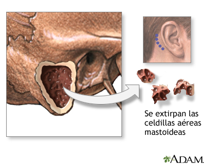 Procedimiento