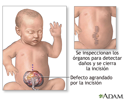 Procedimiento