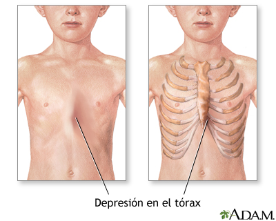 Indicaciones