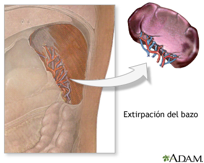 Procedimiento