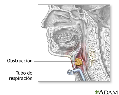 Procedimiento