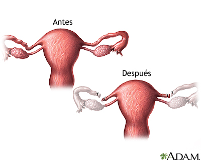 Cuidados postoperatorios