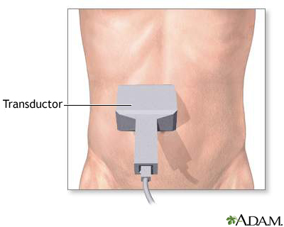 Ultrasonido abdominal