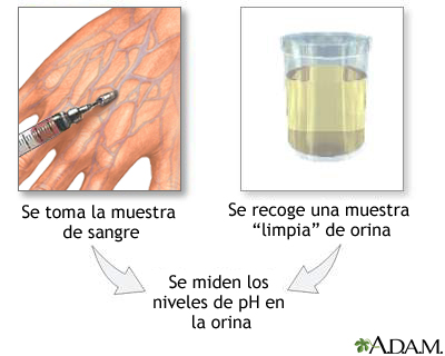 Examen de orina para determinacin del pH