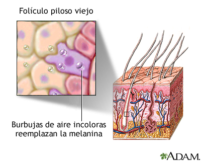 Folículo piloso envejecido