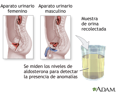 Examen del nivel de aldosterona