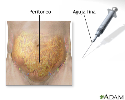 Muestra de peritoneo