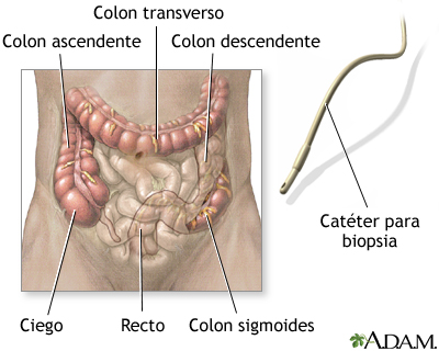 Colonoscopia