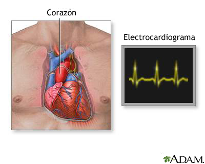 Electrocardiograma (ECG)