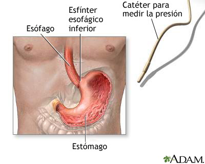 Manometr&#237;a esof&#225;gica