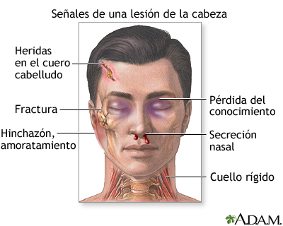 Indicios de lesión de la cabeza