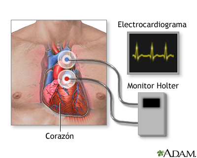 Monitoreo card&#237;aco Holter