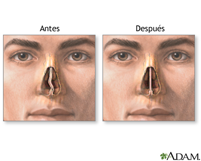 Cuidados postoperatorios