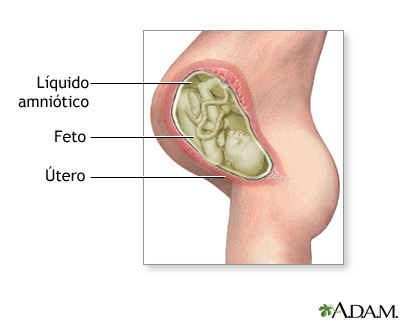 Líquido amniótico