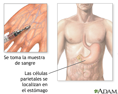 Anticuerpos de las células parietales