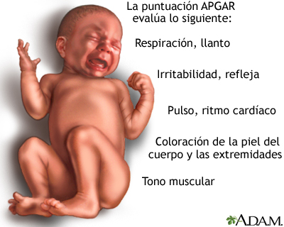 Examen del recién nacido