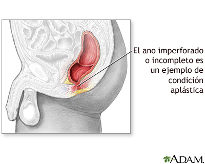 Condicin aplsica