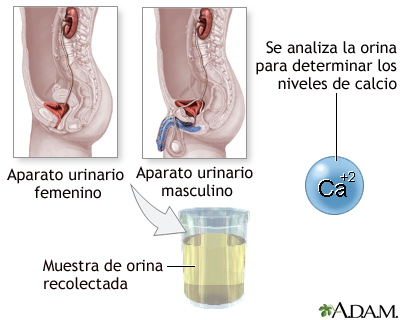 Examen de calcio en orina