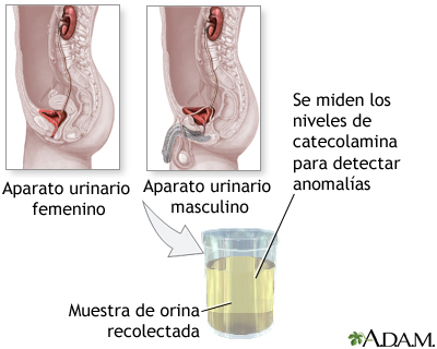 Examen de catecolaminas en orina