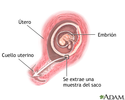 Muestra de vellosidad coriónica