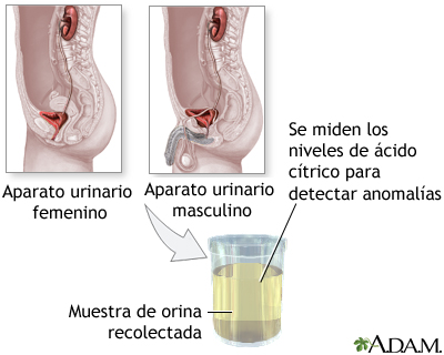 Prueba del ácido cítrico en la orina