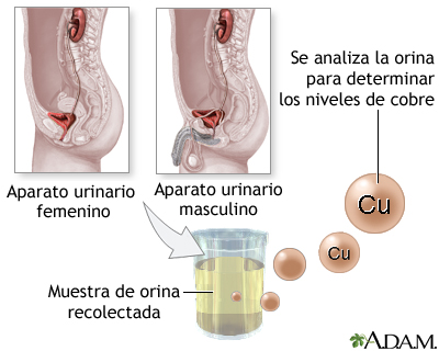 Examen de cobre en orina