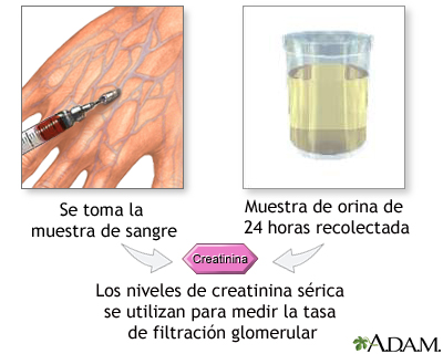 Pruebas de creatinina