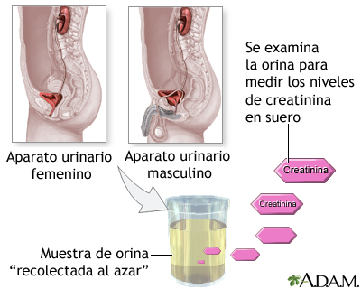 Prueba de creatinina en orina