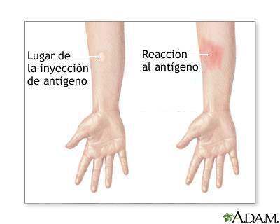 Examen de piel EAG