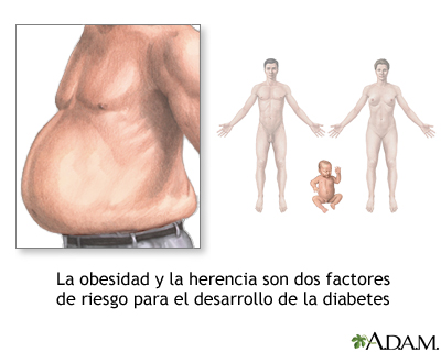 Factores de riesgo de diabetes